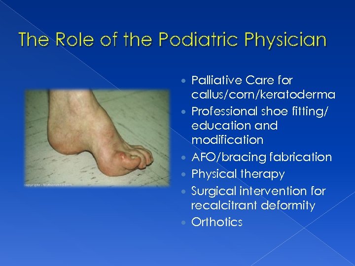 The Role of the Podiatric Physician Palliative Care for callus/corn/keratoderma Professional shoe fitting/ education