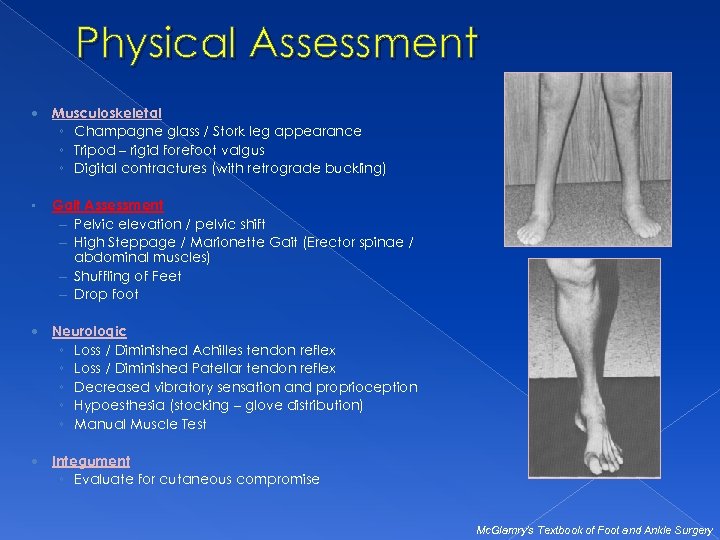 Physical Assessment Musculoskeletal ◦ Champagne glass / Stork leg appearance ◦ Tripod – rigid