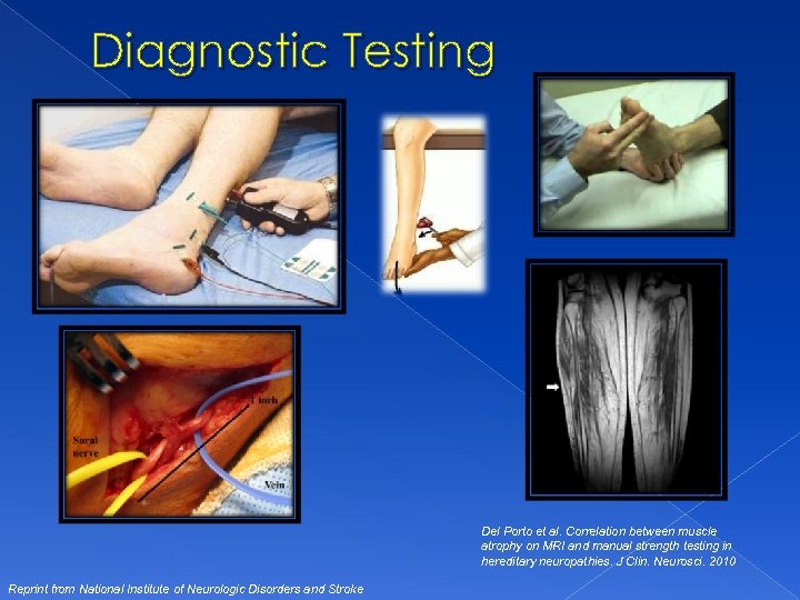 Diagnostic Testing Del Porto et al. Correlation between muscle atrophy on MRI and manual