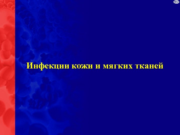 Инфекции кожи и мягких тканей 