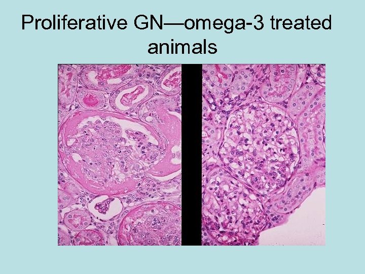 Proliferative GN—omega-3 treated animals 