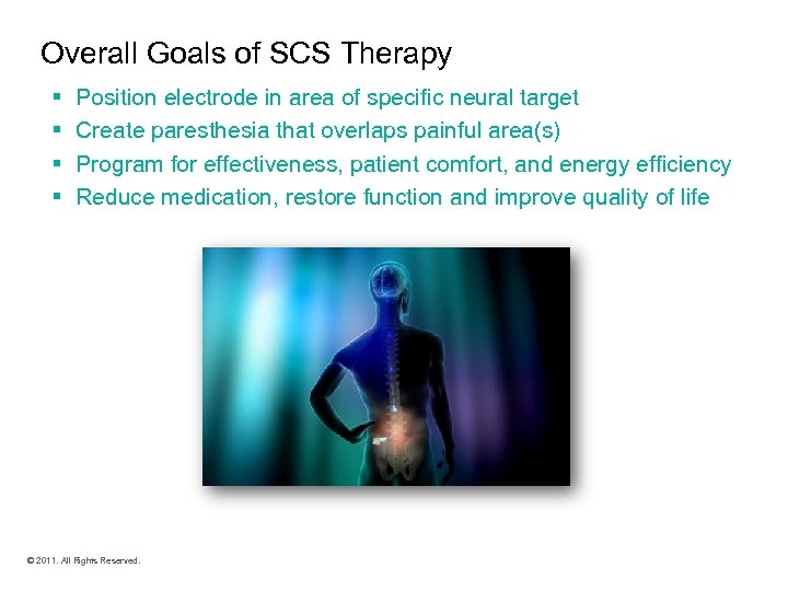 Overall Goals of SCS Therapy § § Position electrode in area of specific neural