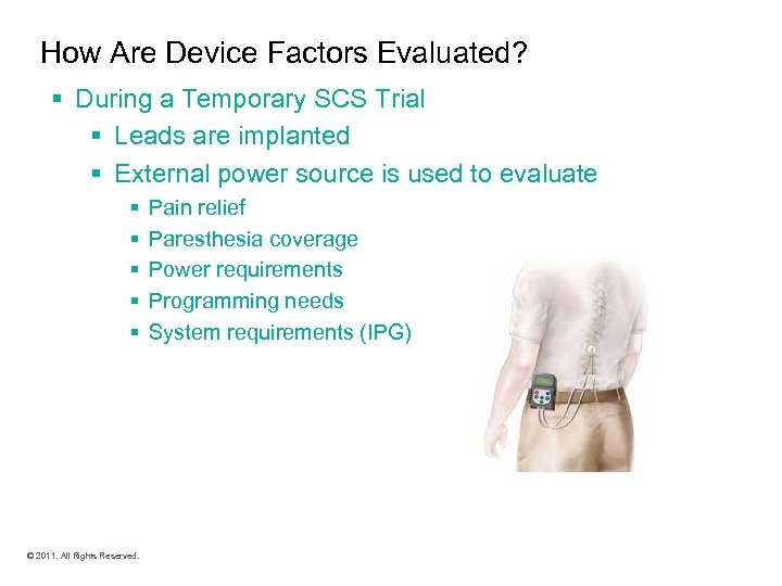 How Are Device Factors Evaluated? § During a Temporary SCS Trial § Leads are