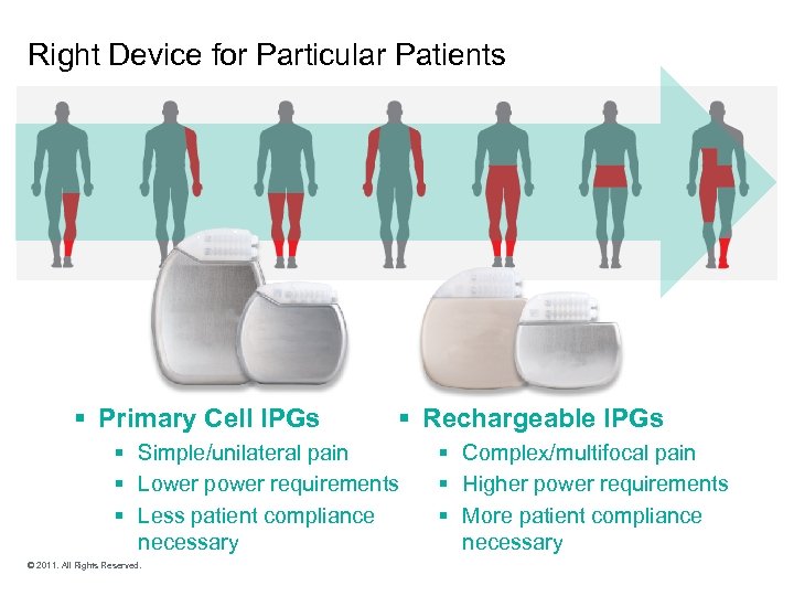 Right Device for Particular Patients § Primary Cell IPGs § Rechargeable IPGs § Simple/unilateral