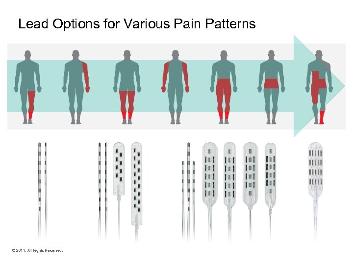 Lead Options for Various Pain Patterns © 2011. All Rights Reserved. 