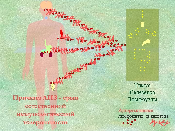 Причина АИЗ - срыв естественной иммунологической толерантности Тимус Селезенка Лимфоузлы Аутореактивные лимфоциты и антитела