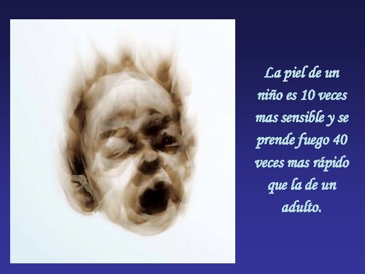 La piel de un niño es 10 veces mas sensible y se prende fuego