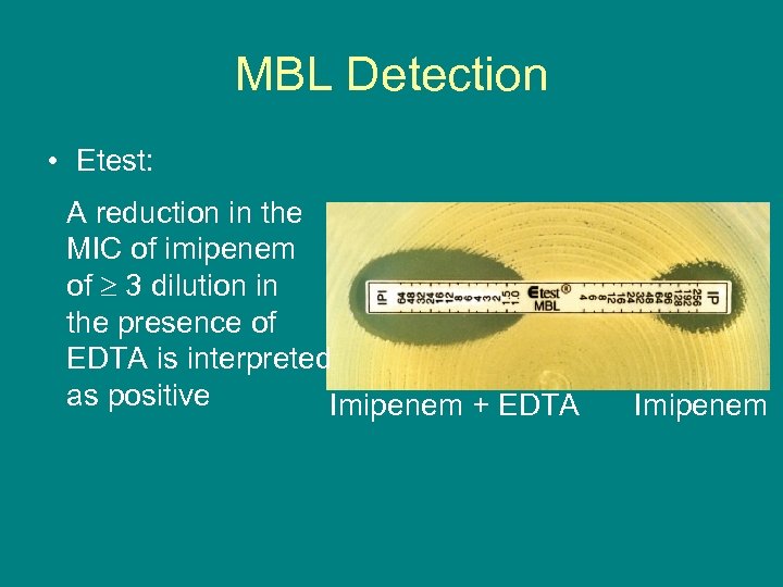 MBL Detection • Etest: A reduction in the MIC of imipenem of 3 dilution