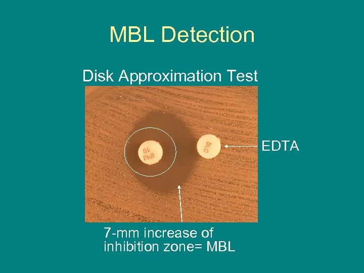 MBL Detection Disk Approximation Test EDTA 7 -mm increase of inhibition zone= MBL 