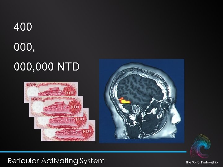 400 000, 000 NTD Reticular Activating System 