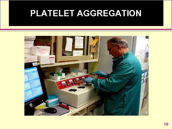 PLATELET AGGREGATION 18 