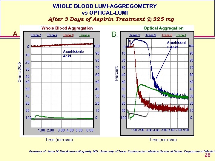 WHOLE BLOOD LUMI-AGGREGOMETRY vs OPTICAL-LUMI After 3 Days of Aspirin Treatment @ 325 mg