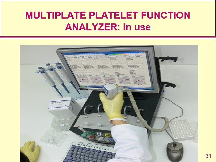 MULTIPLATELET FUNCTION ANALYZER: In use 31 