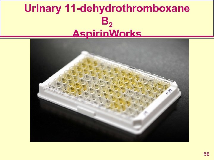 Urinary 11 -dehydrothromboxane B 2 Aspirin. Works 56 