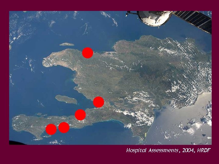 Hospital Assessments, 2004, HRDF 