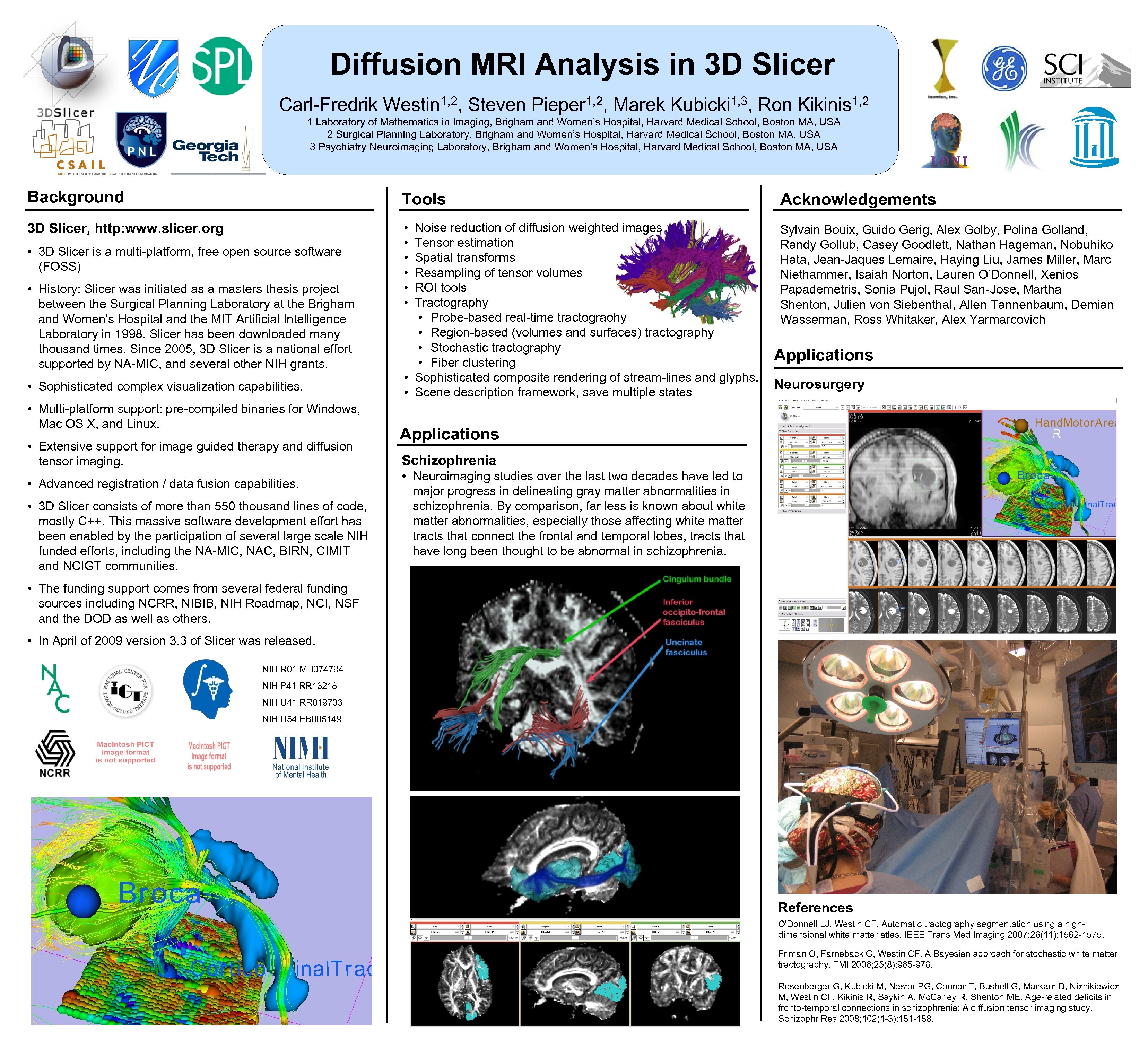 Diffusion MRI Analysis in 3 D Slicer 1, 2, Steven Pieper 1, 2, Marek