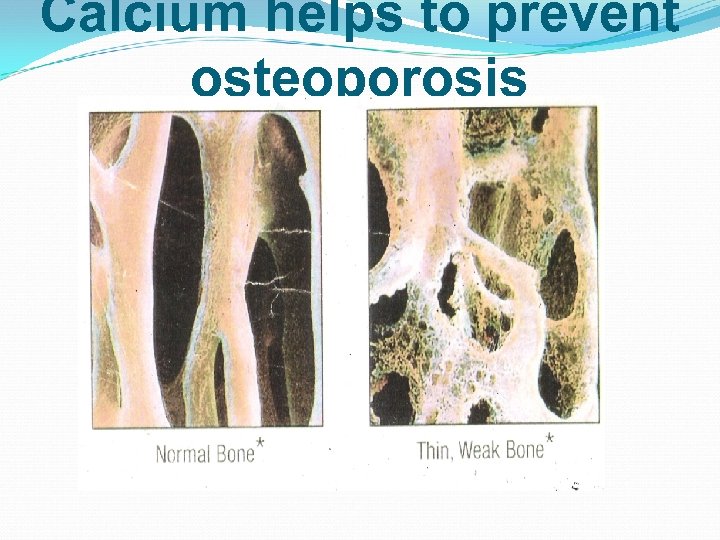 Calcium helps to prevent osteoporosis 