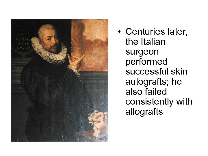  • Centuries later, the Italian surgeon performed successful skin autografts; he also failed