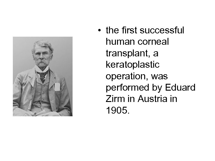  • the first successful human corneal transplant, a keratoplastic operation, was performed by