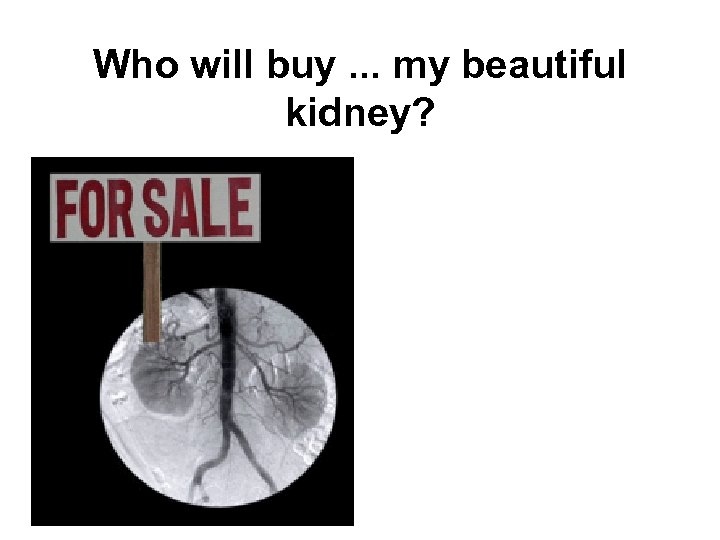 Who will buy. . . my beautiful kidney? 