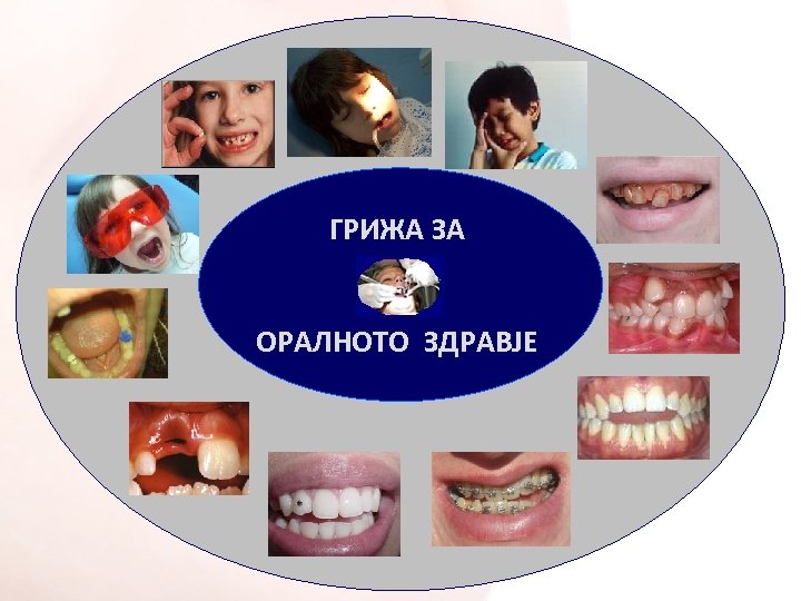 ГРИЖА ЗА OРАЛНОТО ЗДРАВЈЕ 