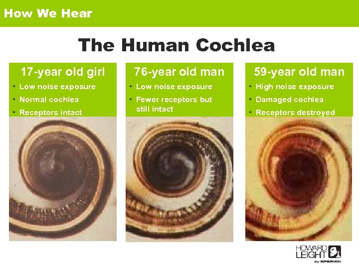 How We Hear The Human Cochlea 17 -year old girl 76 -year old man