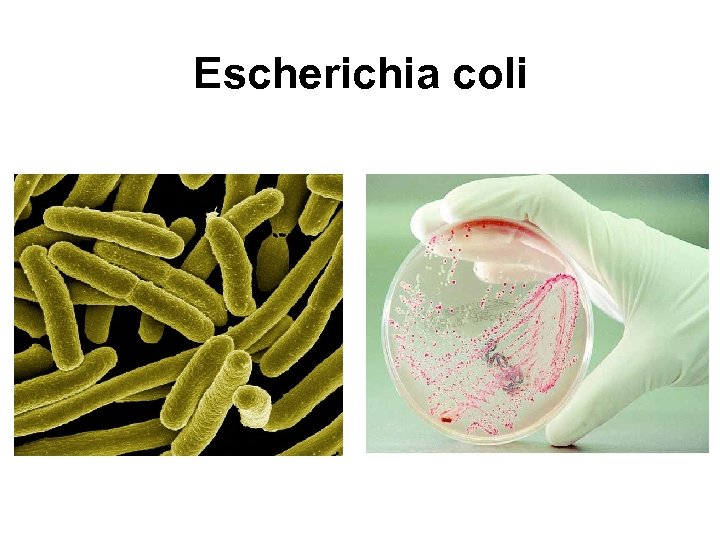 Escherichia coli 