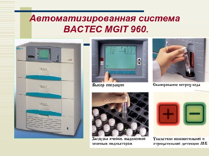 Автоматизированная система BACTEC MGIT 960. 