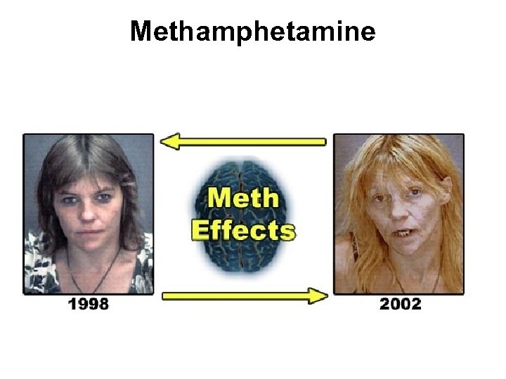 Methamphetamine 