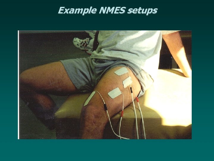 Example NMES setups 