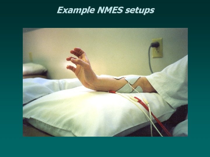 Example NMES setups 