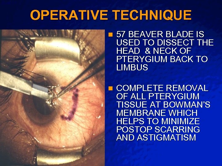 Slide 11 © 2003 By Default! OPERATIVE TECHNIQUE n n A Free sample background