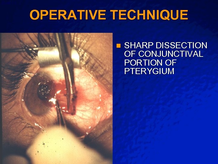 Slide 13 © 2003 By Default! OPERATIVE TECHNIQUE n A Free sample background from