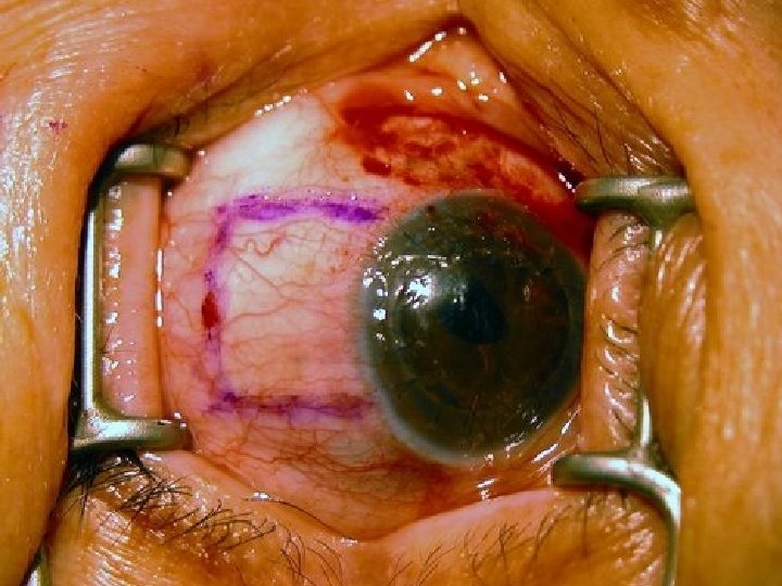 Slide 16 A Free sample background from www. awesomebackgrounds. com © 2003 By Default!