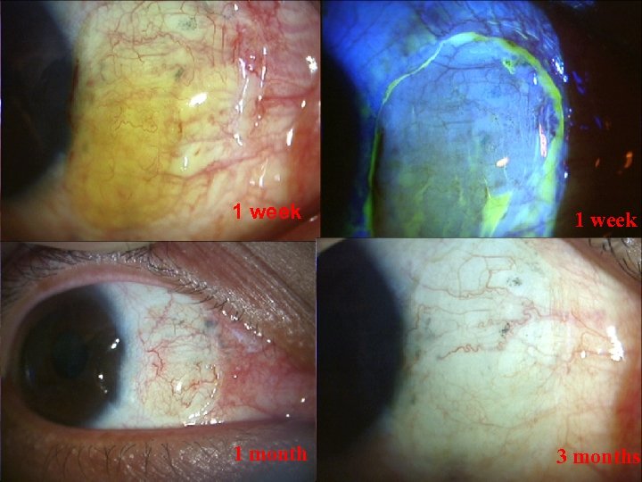 Slide 23 © 2003 By Default! 1 week 1 month 3 months A Free