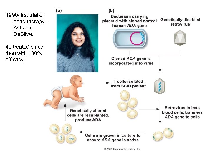 1990 -first trial of gene therapy – Ashanti De. Silva. 40 treated since then