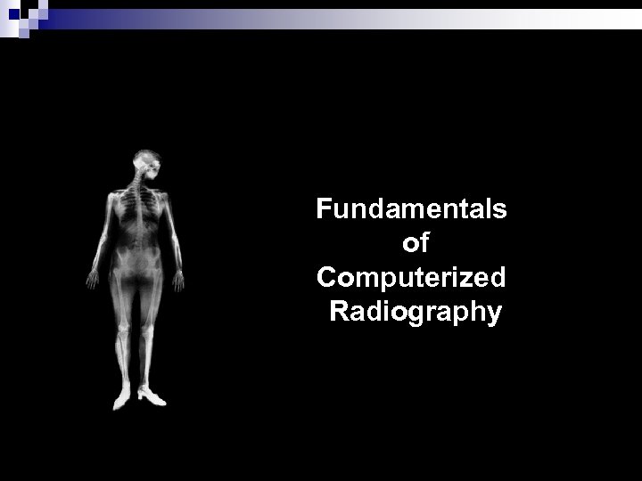 Fundamentals of Computerized Radiography 
