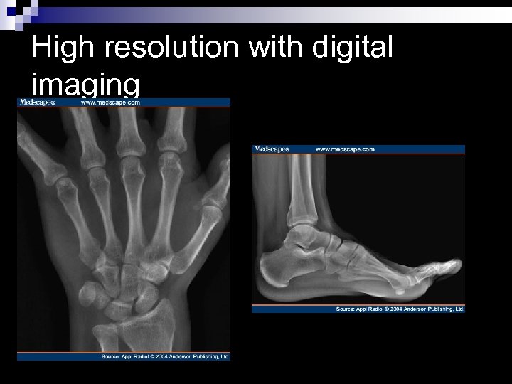 High resolution with digital imaging 