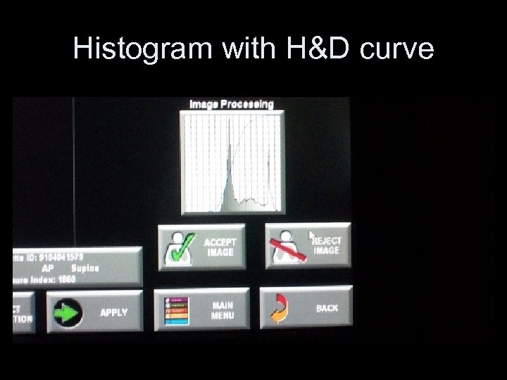 Histogram with H&D curve 