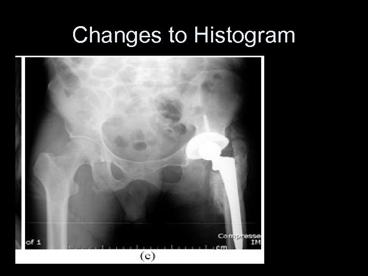 Changes to Histogram 