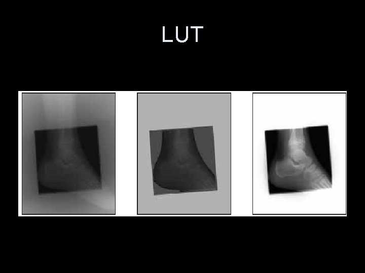 LUT 