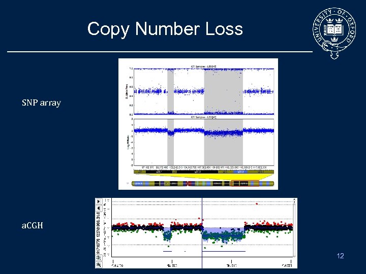 Copy Number Loss SNP array a. CGH 12 