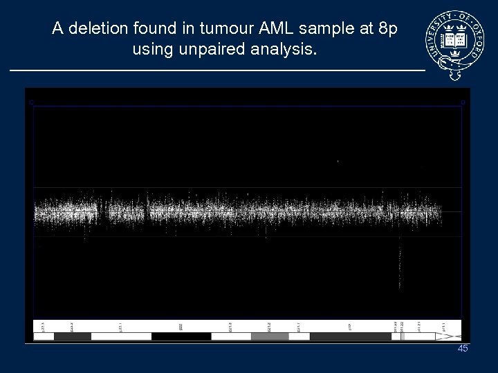 A deletion found in tumour AML sample at 8 p using unpaired analysis. Tumour