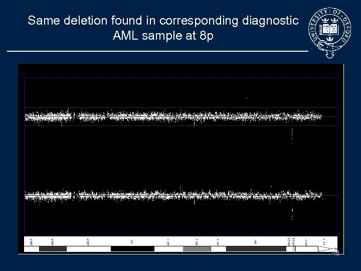 Same deletion found in corresponding diagnostic AML sample at 8 p Tumour sample vs
