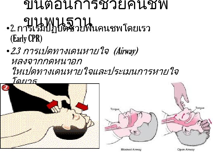 ขนตอนการชวยคนชพ ขนพนฐาน • 2. การเรมปฏบตชวยฟนคนชพโดยเรว (Early CPR) • 2. 3 การเปดทางเดนหายใจ (Airway) หลงจากกดหนาอก ใหเปดทางเดนหายใจและประเมนการหายใจ