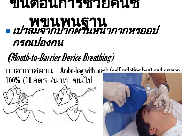 ขนตอนการชวยคนช พขนพนฐาน n เปาลมจากปากผานหนากากหรออป กรณปองกน (Mouth-to-Barrier Device Breathing) บบอากาศผาน Ambu-bag with mask (self-inflating bag)