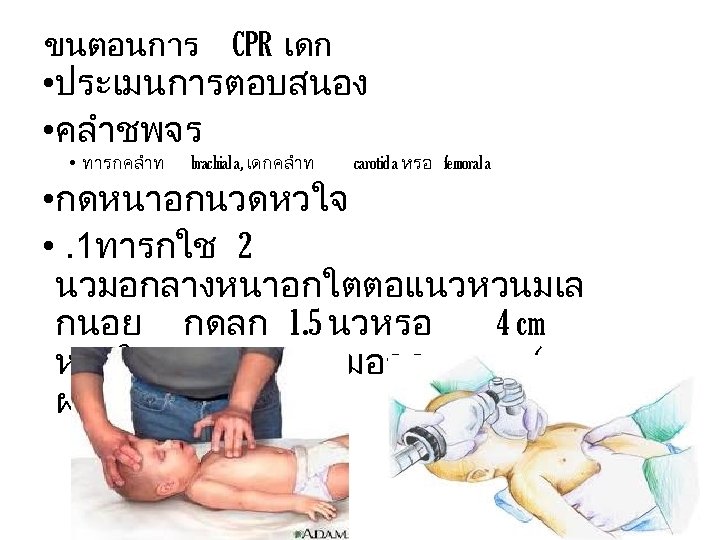 ขนตอนการ CPR เดก • ประเมนการตอบสนอง • คลำชพจร • ทารกคลำท brachial a, เดกคลำท carotid a