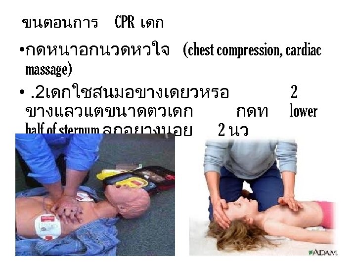 ขนตอนการ CPR เดก • กดหนาอกนวดหวใจ (chest compression, cardiac massage) • . 2เดกใชสนมอขางเดยวหรอ 2 ขางแลวแตขนาดตวเดก