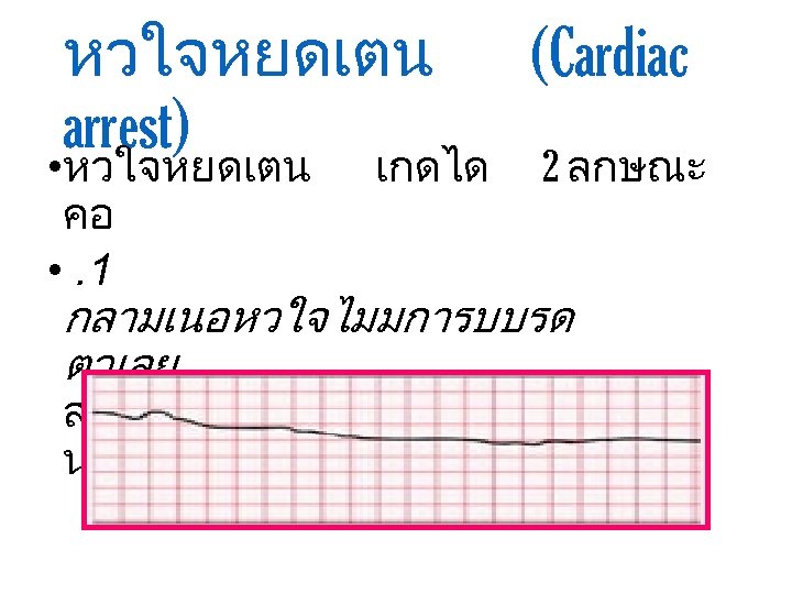 หวใจหยดเตน arrest) (Cardiac • หวใจหยดเตน เกดได 2 ลกษณะ คอ • . 1 กลามเนอหวใจไมมการบบรด ตวเลย