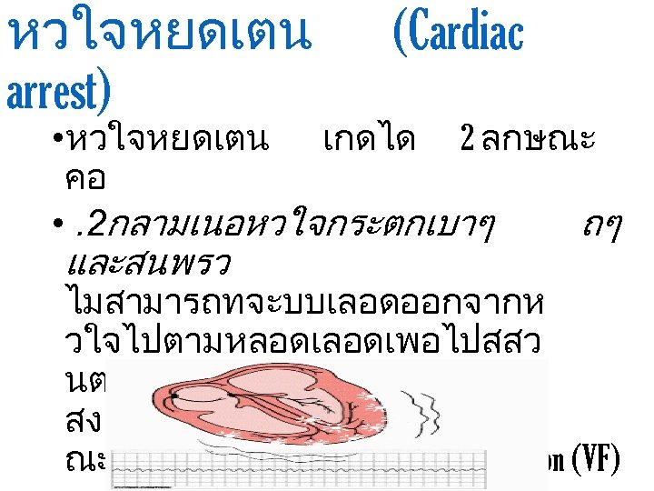 หวใจหยดเตน arrest) (Cardiac • หวใจหยดเตน เกดได 2 ลกษณะ คอ • . 2กลามเนอหวใจกระตกเบาๆ ถๆ และสนพรว